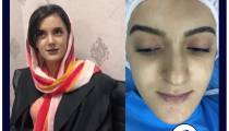 جراحی زیبائی بینی