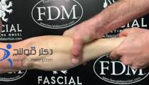 FDM جدیدترین روش درمان