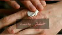 درمان دیابت و کاهش انسولین کاملا گیاهی