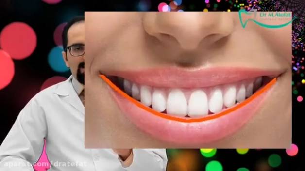 لبخند هالیوودی چیست ؟