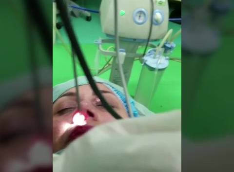 جراحی زیبایی بینی