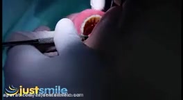 کلینیک دندانپزشکی تاج | دندانپزشکی کودکان | ایمپلنت